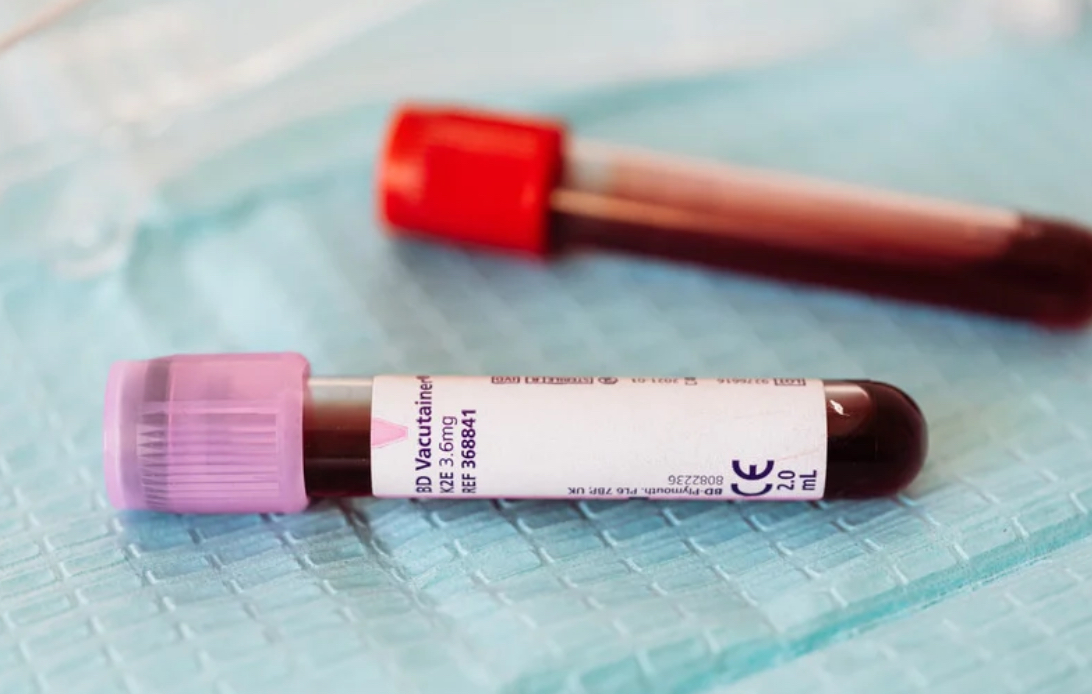 Blood sample tube for private blood testing at Enigma Healthcare in Tarporley, Cheshire