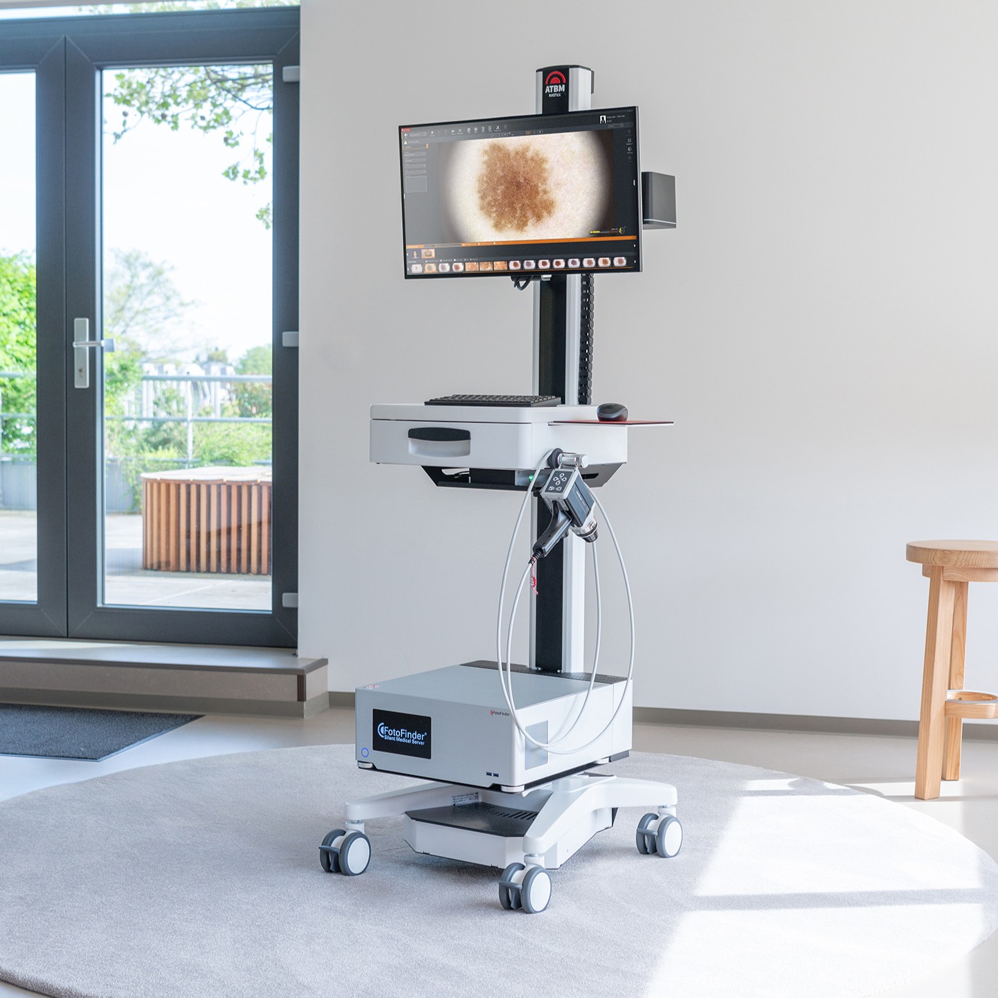 FotoFinder ATBM automated total body mapping system used for whole body mole mapping at Enigma Healthcare in Tarporley, Cheshire